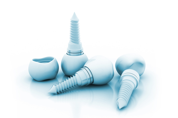 Reasons You May Not Be A Candidate For Dental Implants And How To Fix It