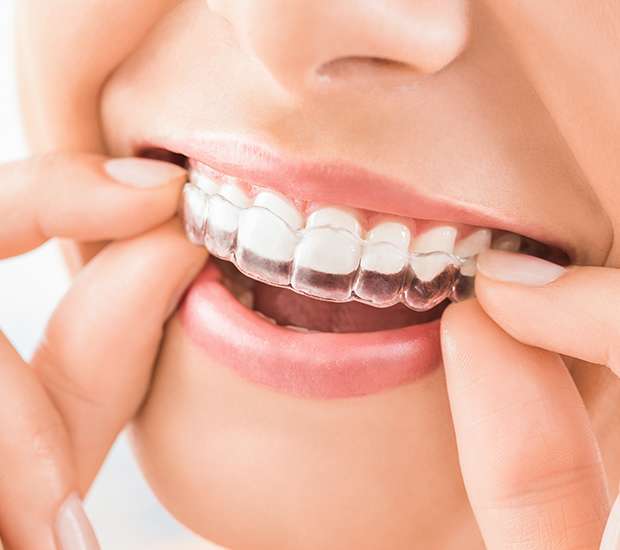 Atlanta Does Invisalign Really Work