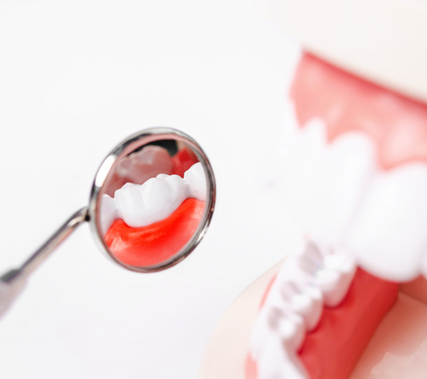 Atlanta Interactive Periodontal Probing